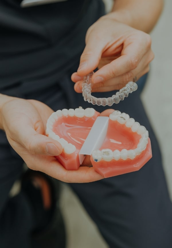 Treatment -  The Observatory Dental