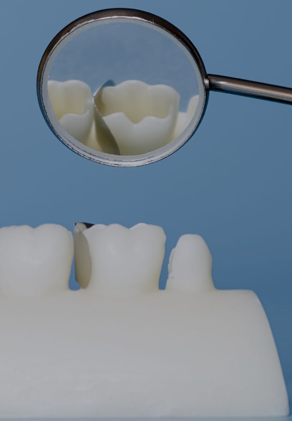 Treatment -  The Observatory Dental