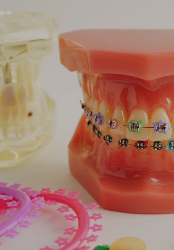 Treatment -  The Observatory Dental