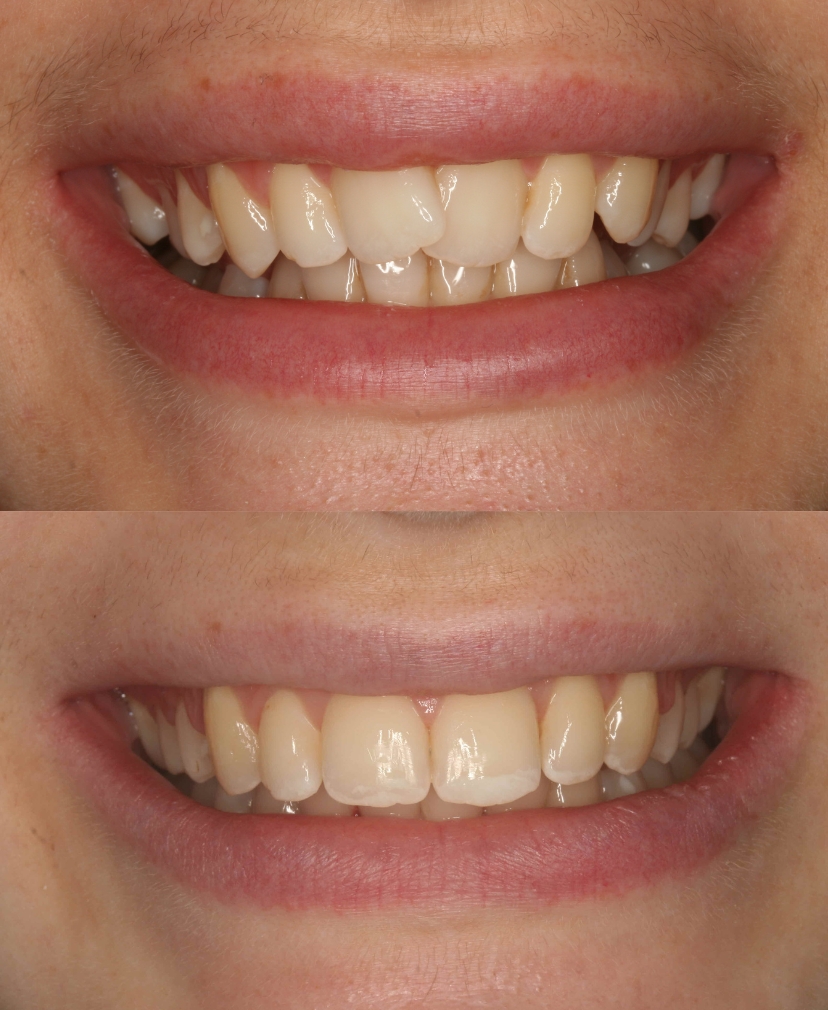 Orthodontics